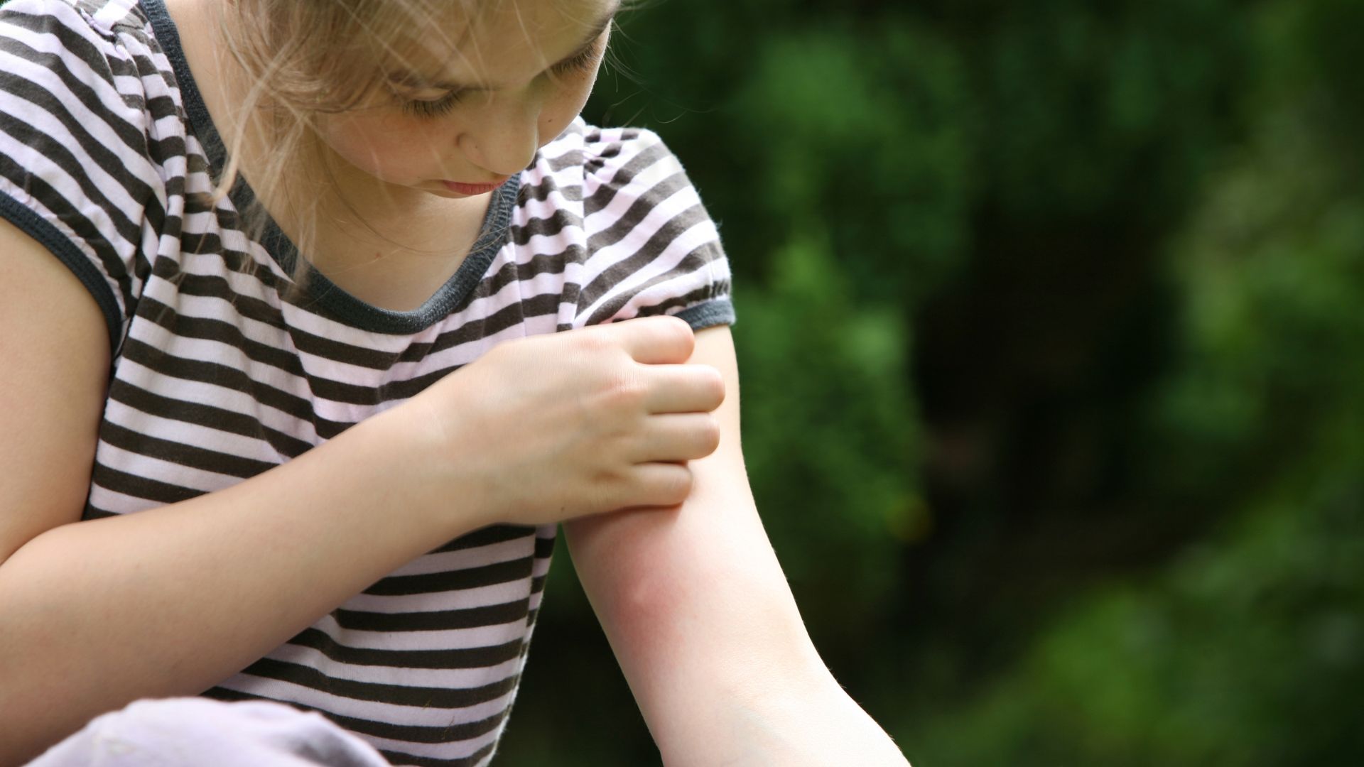 Ukąszenia owadów u dzieci - jak sobie z nimi radzić?